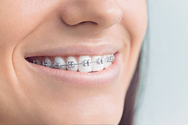 Best Full Mouth Reconstruction  in Percy, IL